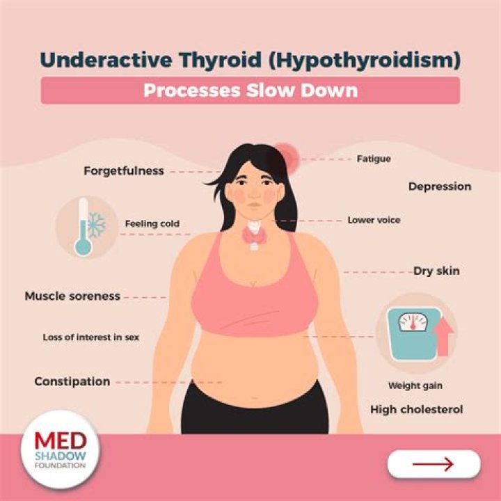 Understanding Joyce Vance's Thyroid Condition: A Deep Dive