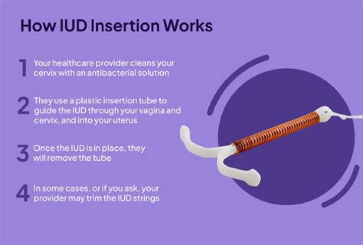 Understanding the Dynamics of IUDs: My Boyfriend Can Feel My IUD and It Hurts Him