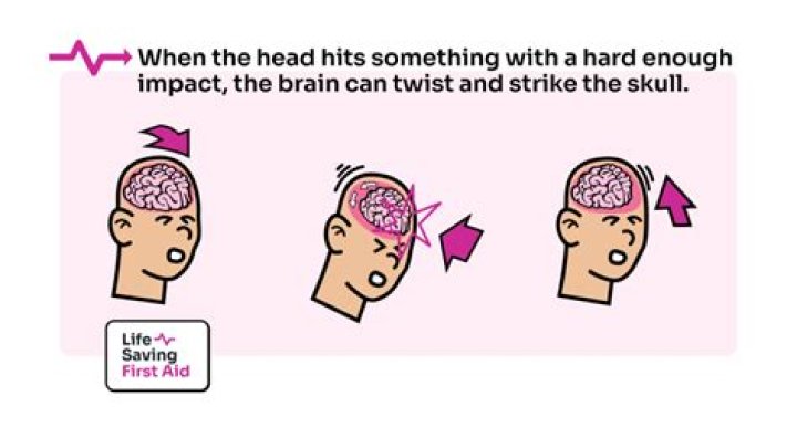 Understanding the Impact of Being Hit in the Back of the Head in Boxing