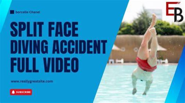 Understanding the Split Face Diving Accident: Causes, Impacts, and Prevention