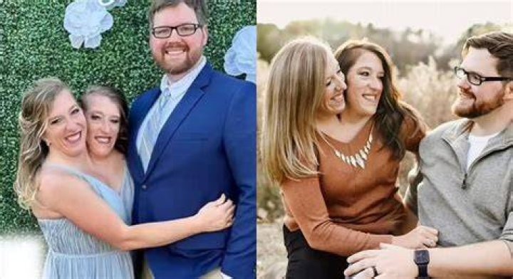 Understanding the Tragic News Surrounding Abby and Brittany Hensel's Cause of Death