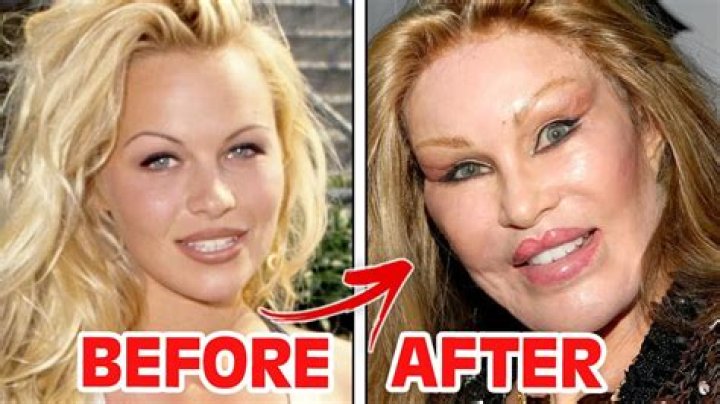 Understanding the Worst Aesthetic Surgery: Common Mistakes and Consequences
