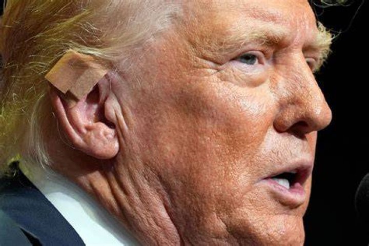 Understanding Trump Bandage: A Comprehensive Guide
