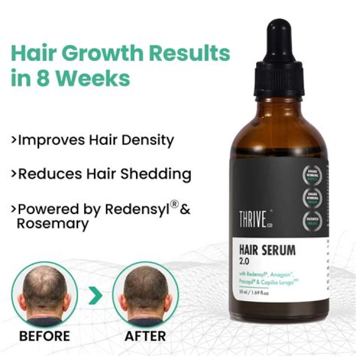 Unlocking the Secrets of Hair Growth Serum: A Comprehensive Guide