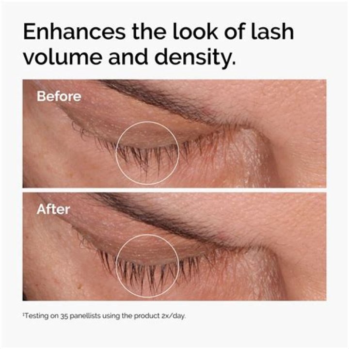 Unlocking the Secrets of Ordinary Lash Serum: A Comprehensive Guide