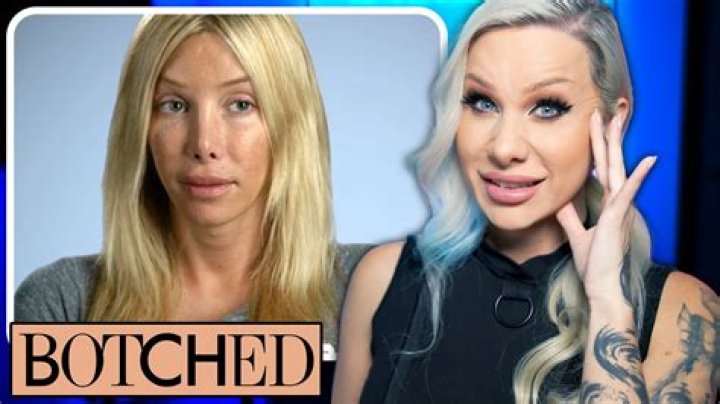 Unraveling the Mystery of Kimber James Botched: A Journey Through Transformation