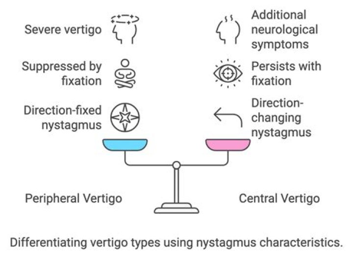 Unveiling the Dynamics of Vertigo Drive: A Comprehensive Guide