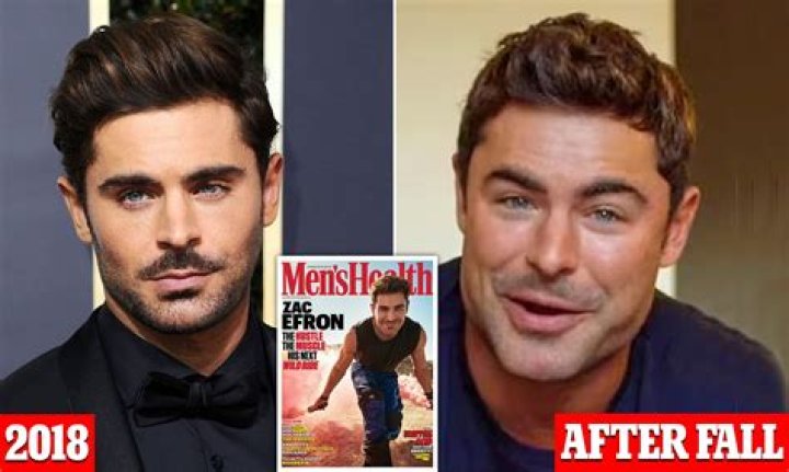 Unveiling the Transformation: Zac Efron's New Face