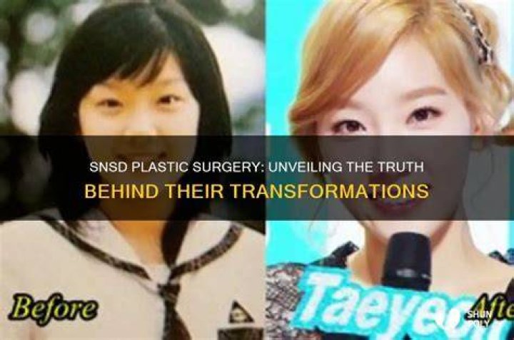 Unveiling the Truth: SNSD Plastic Surgery Insights