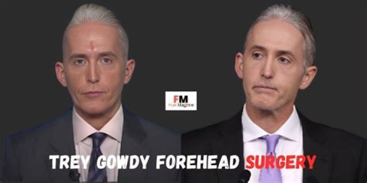 What Happened to Trey Gowdy's Forehead: A Deep Dive into the Controversy