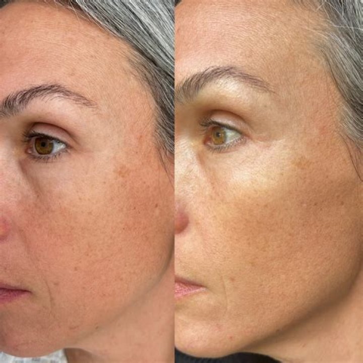 What is the Best Oil to Apply on Face?