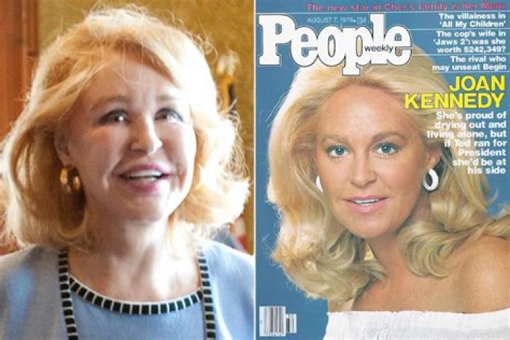 Where is Joan Kennedy Today: An Insightful Journey Through Her Life