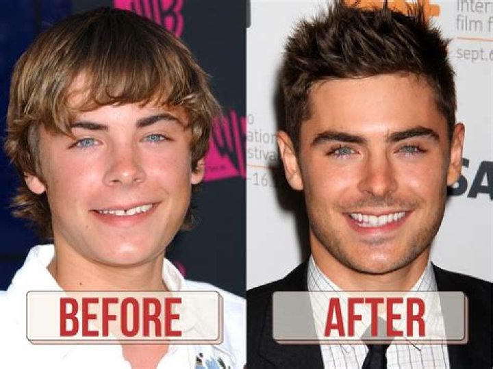 Zac Efron: A Journey Through His Young Years